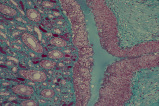 kidney33.tif