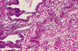 uterus8.tif