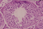 testis17.gif