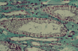 kidney29.tif