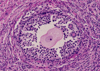 ovary22.tif