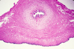 uterus11.tif