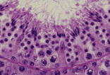 testis11.gif