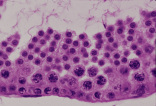 testis12.gif