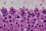 testis13.gif