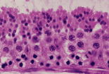 testis14.gif