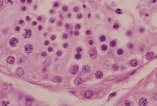 testis18.gif