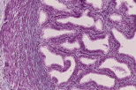 testis31.gif