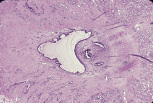 testis37.gif