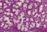 testis38.gif