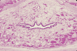 testis40.gif